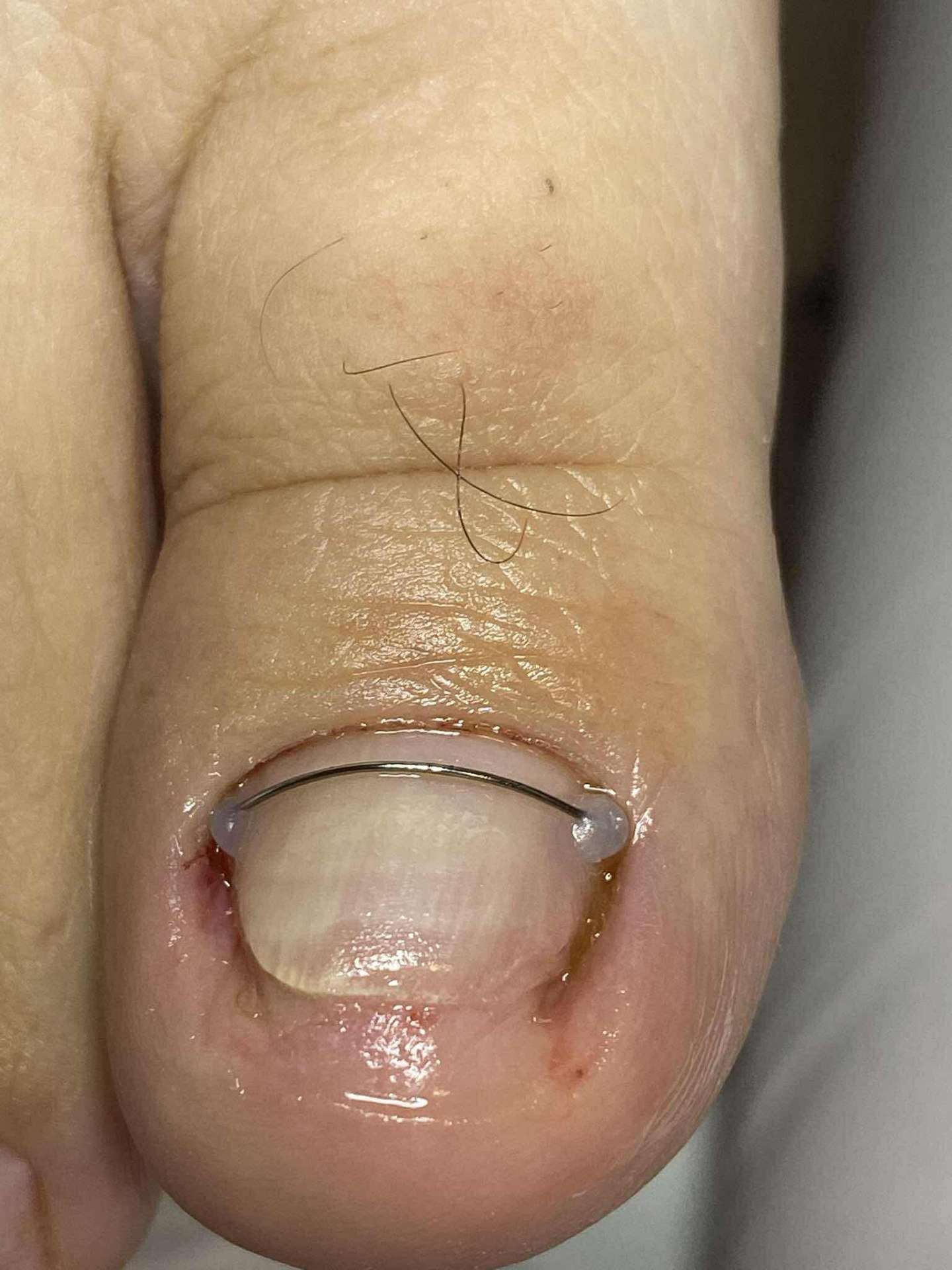 Pedicina munka 4